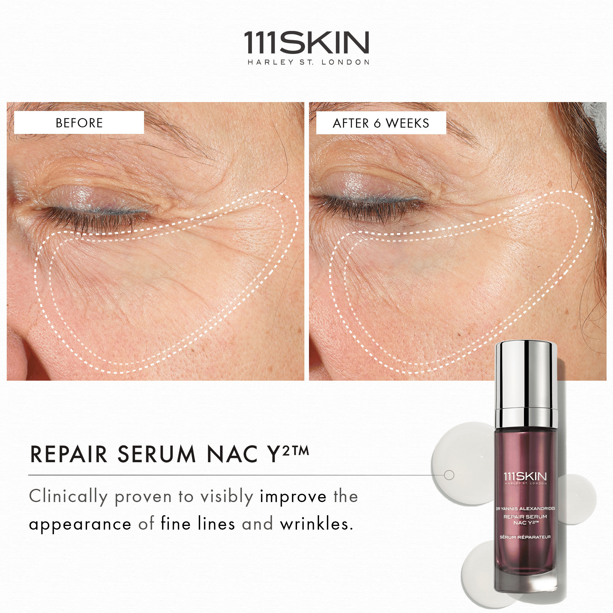 111SKIN Repair Serum NAC Y2