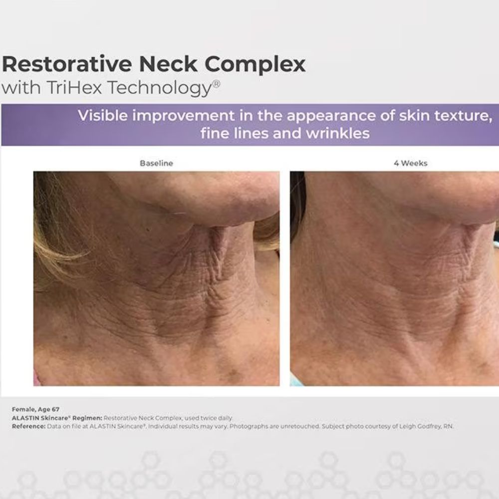 Alastin Skincare® Restorative Neck Complex with TriHex Technology® 50 mL