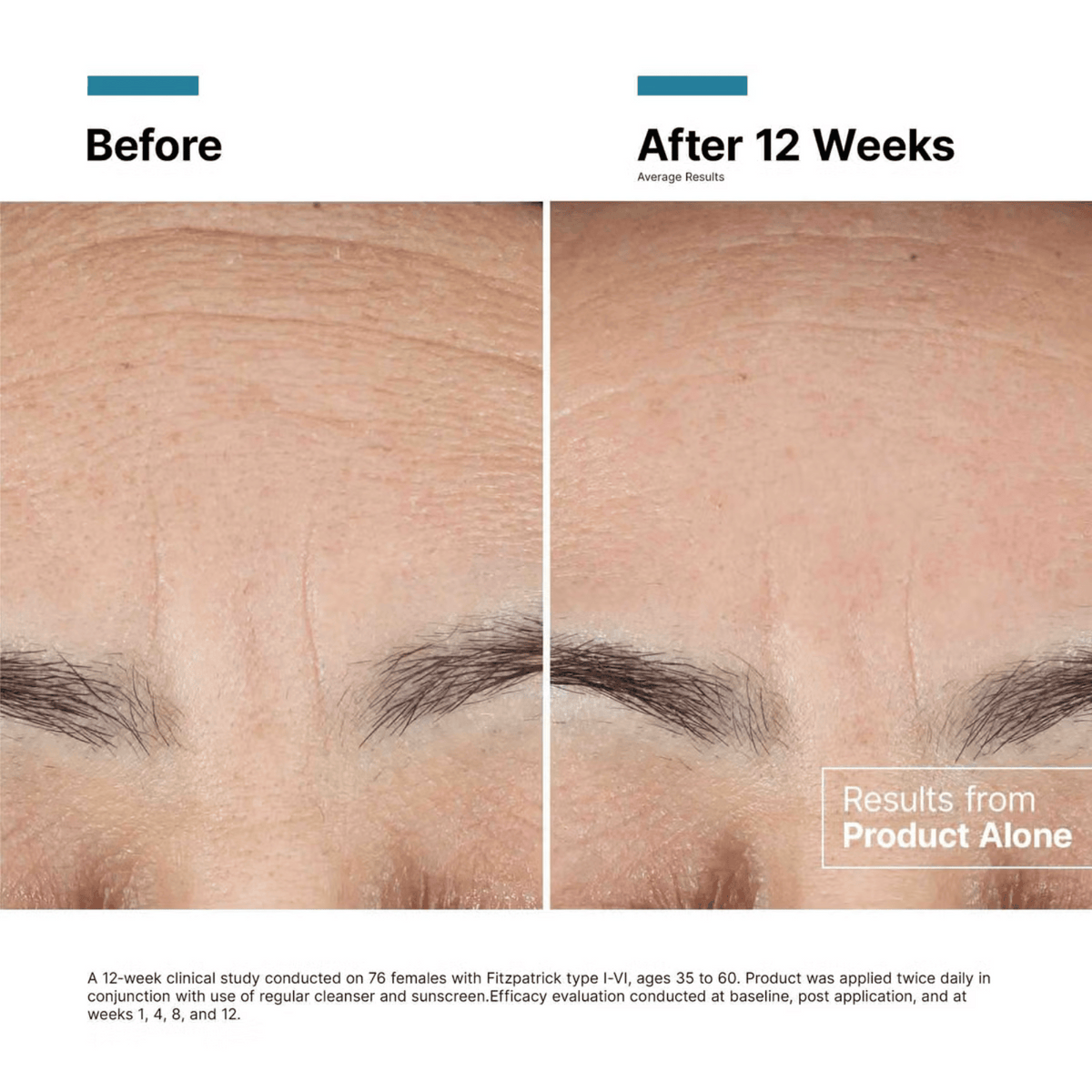 SkinCeuticals Advanced RGN-6 50ml