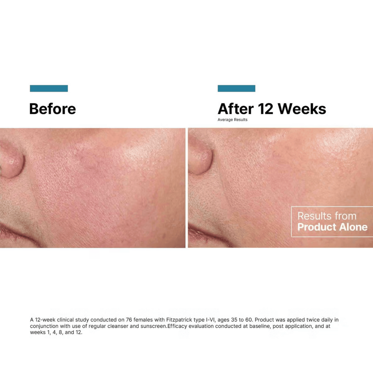 SkinCeuticals Advanced RGN-6 50ml