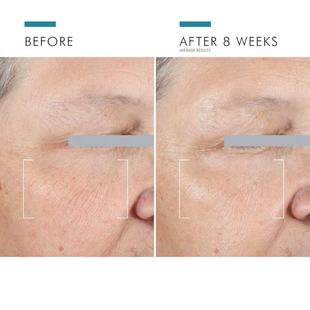 SkinCeuticals A.G.E Advanced Eye
