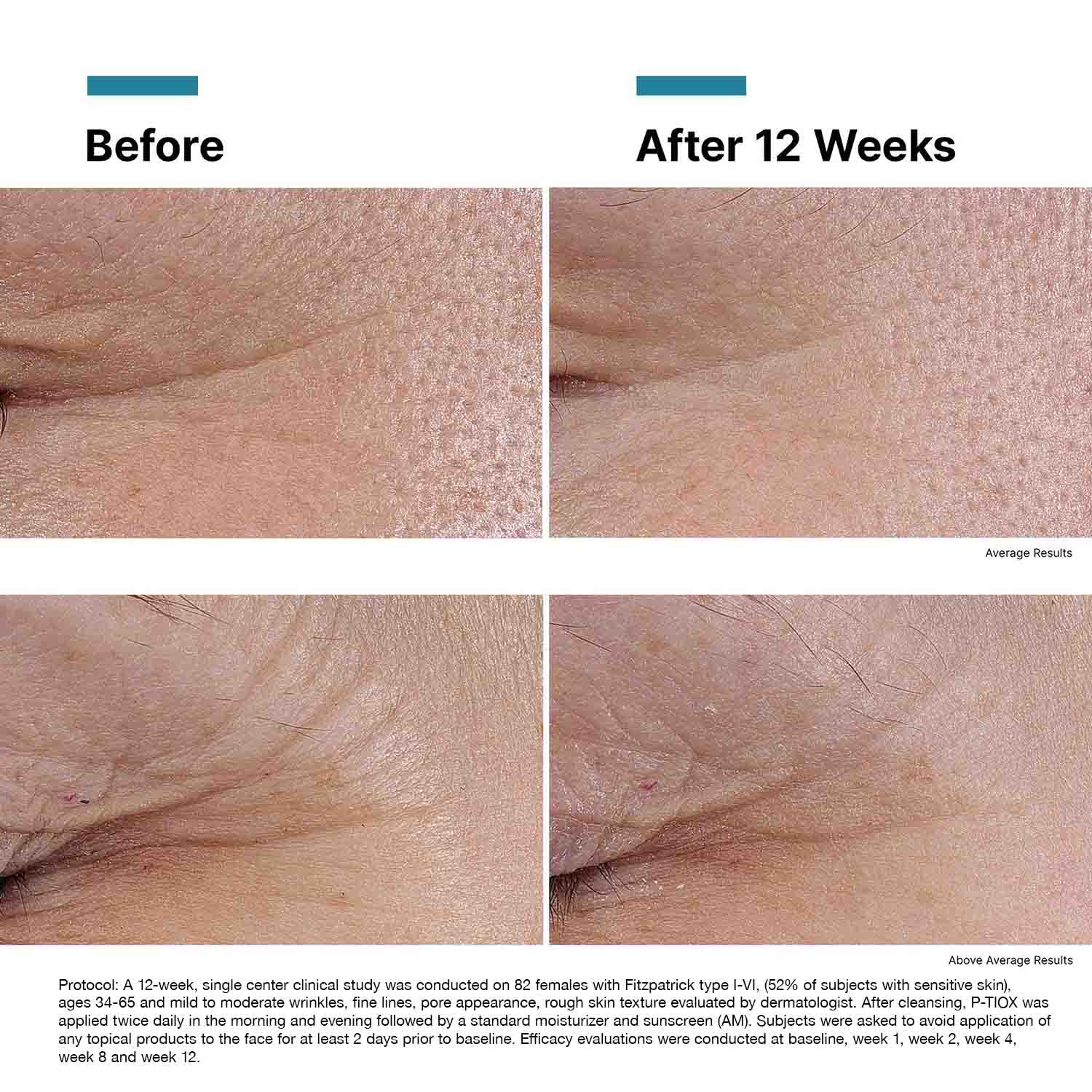 SkinCeuticals P-TIOX SERUM