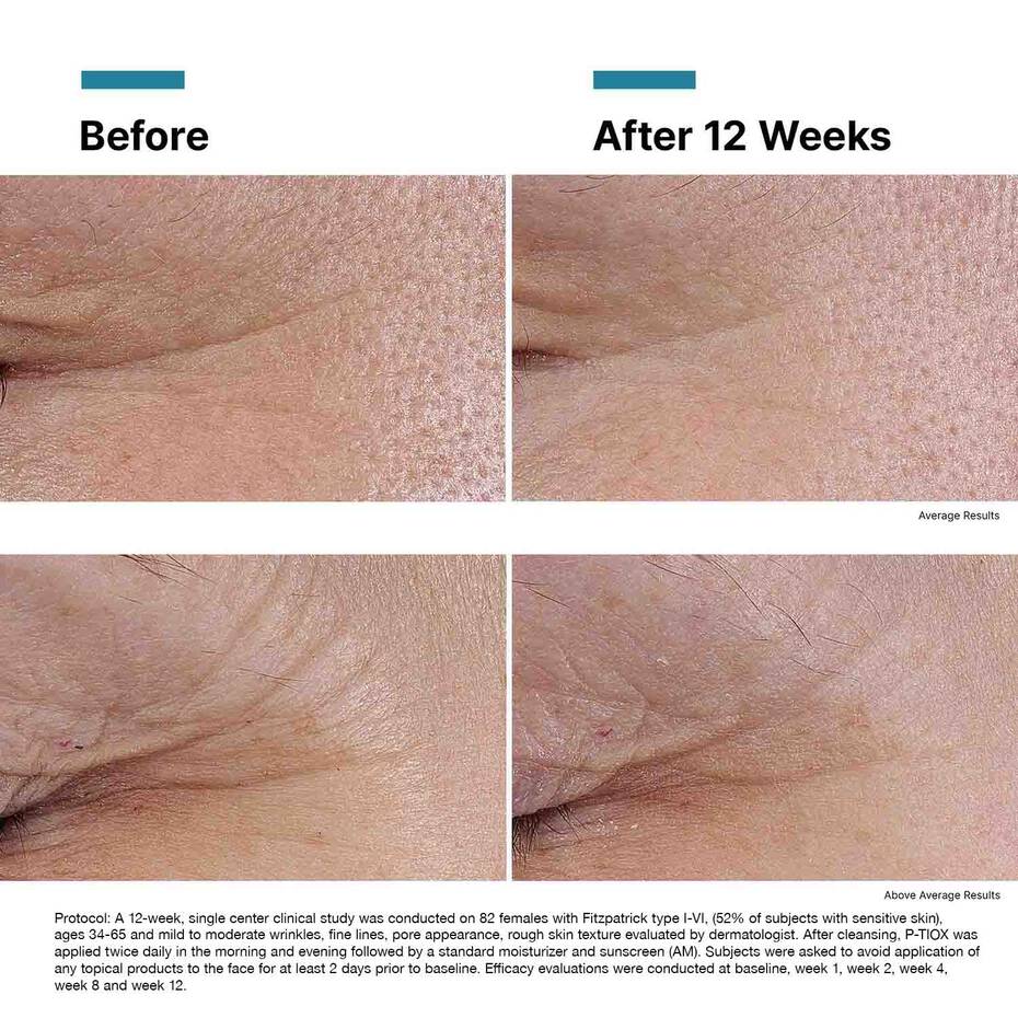 SkinCeuticals P-TIOX Wrinkle Modulating Peptide Serum