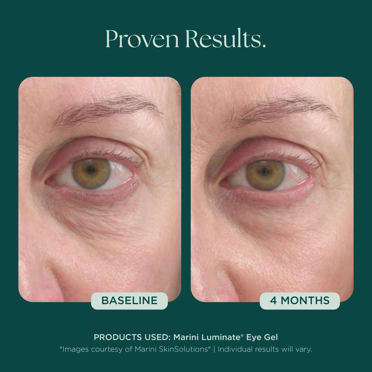 Marini Skin Solutions Marini Luminate Eye Gel