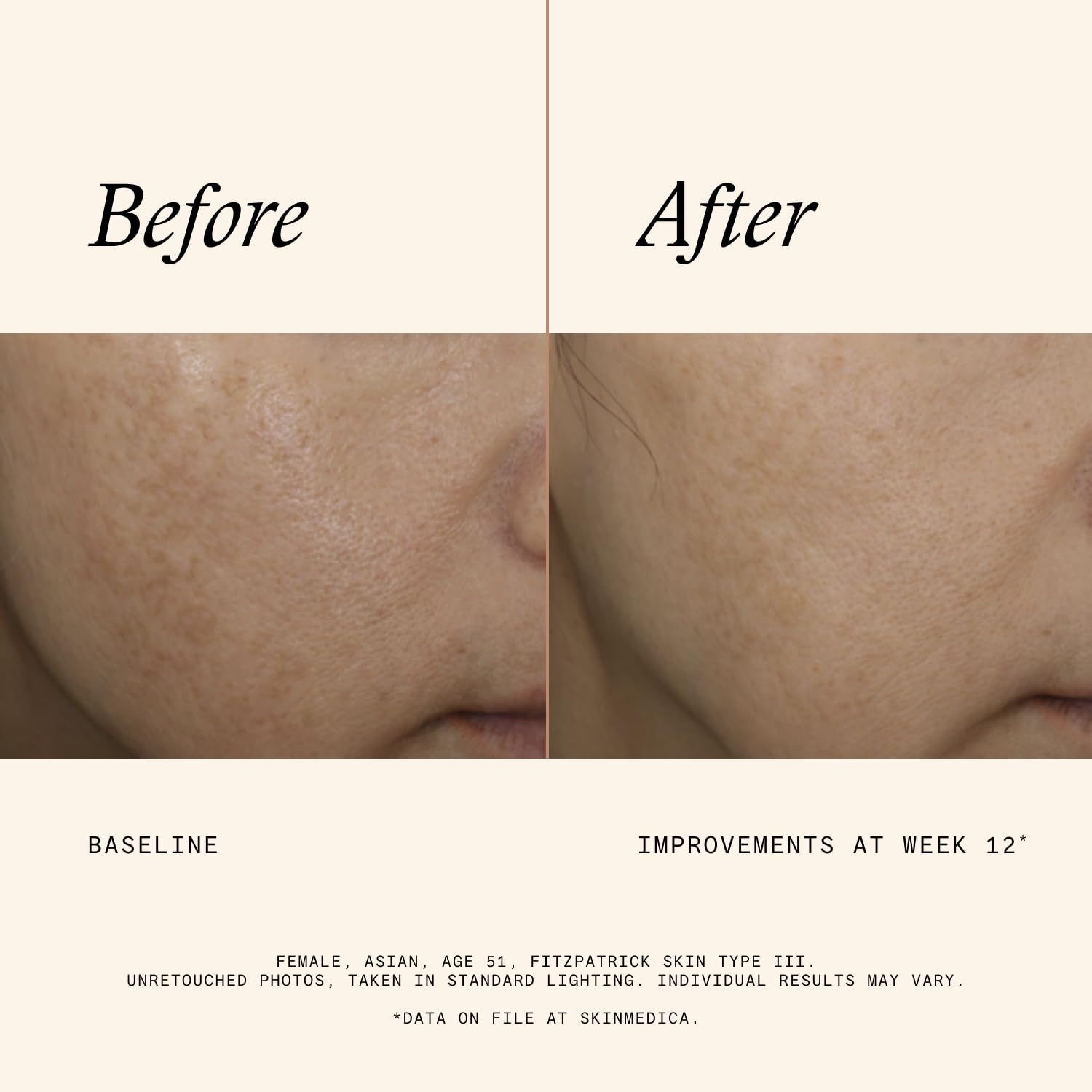 SkinMedica Even & Correct Advanced Brightening Treatment