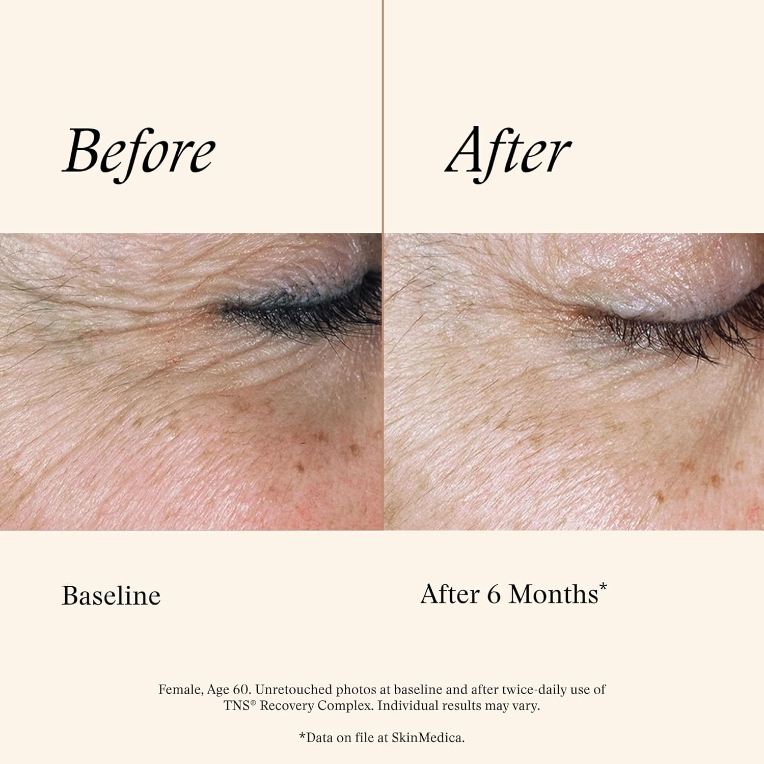 SkinMedica TNS Recovery Complex