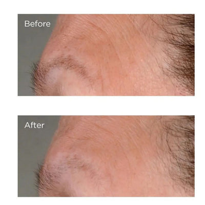 Perricone MD High Potency Growth Factor Firming & Lifting Serum