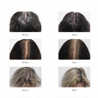 Larimide Kojaxin Stops Hair loss & Stimulates Growth Ampous (15 X 4ml)