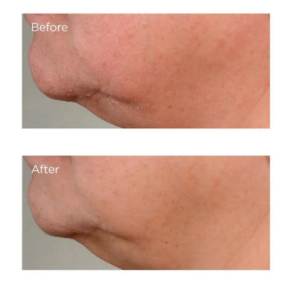 Perricone MD High Potency Growth Factor Firming & Lifting Serum