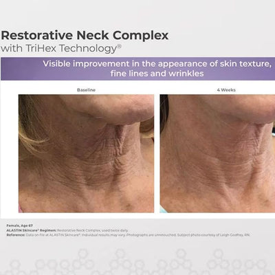 Alastin Restorative Neck Complex with TriHex Technology® 50ml