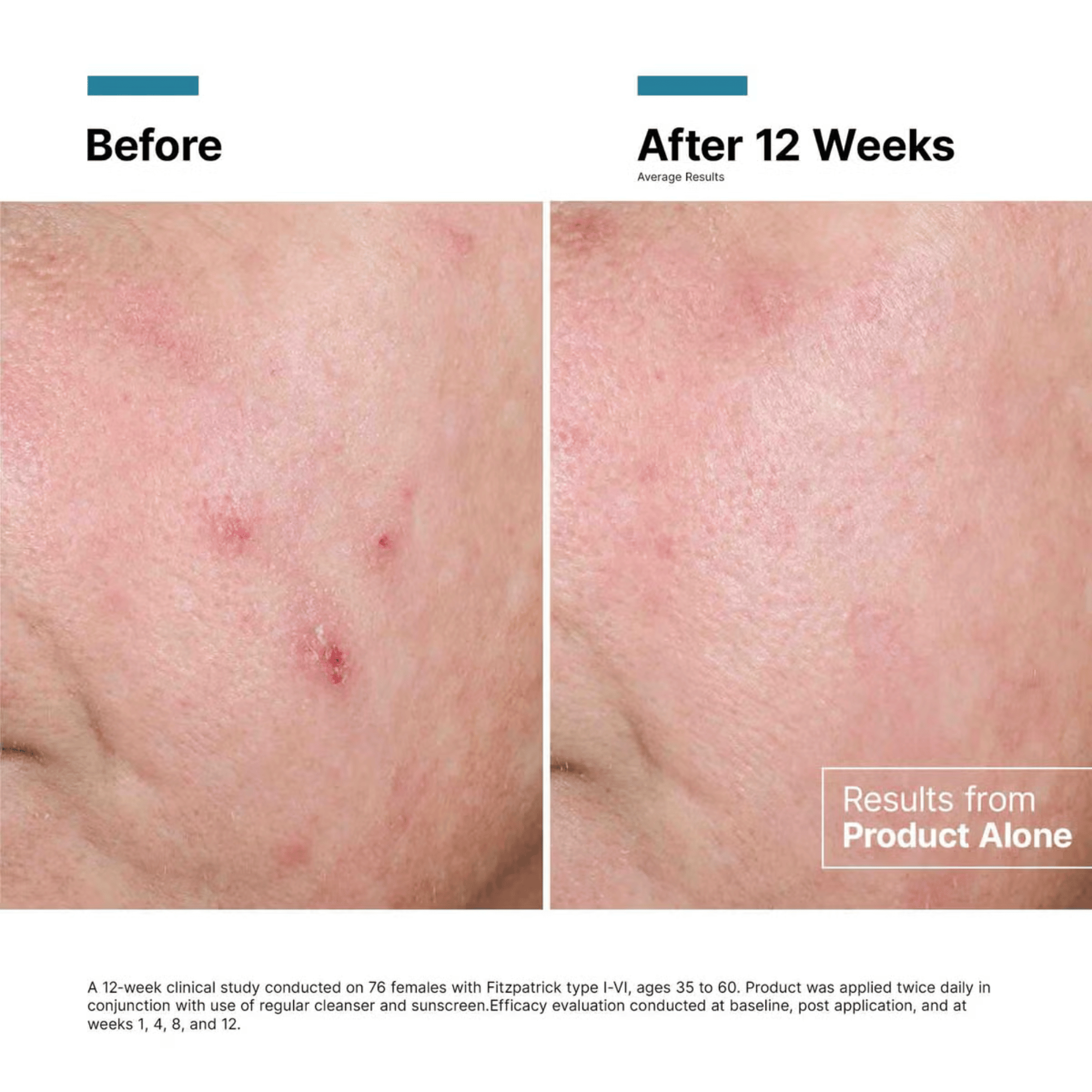 SkinCeuticals Advanced RGN-6 50ml