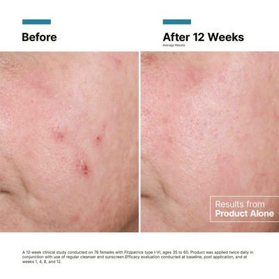 SkinCeuticals Advanced RGN-6 50ml