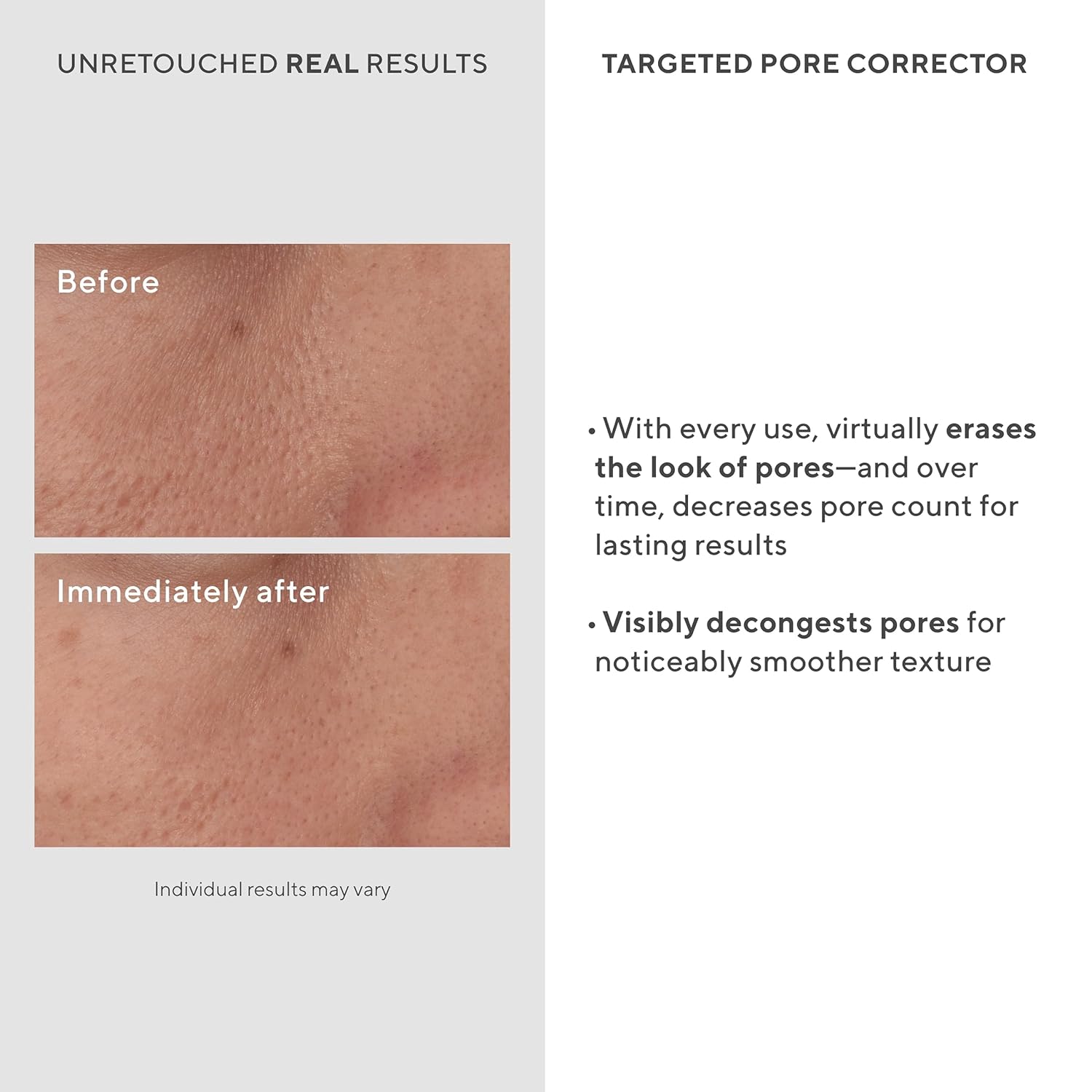 Murad Targeted Pore Corrector