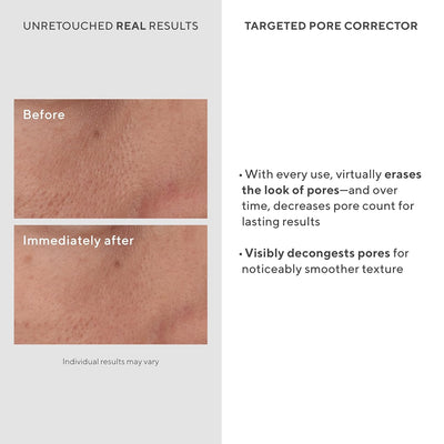 Murad Targeted Pore Corrector