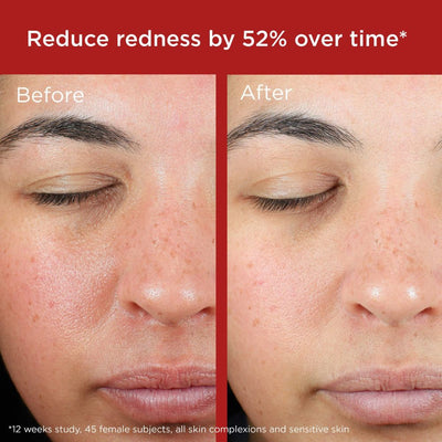 EltaMD UV Skin Recovery Red Color Correcting Green Tint Broad Spectrum SPF 50