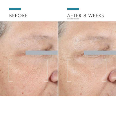 SkinCeuticals A.G.E Advanced Eye