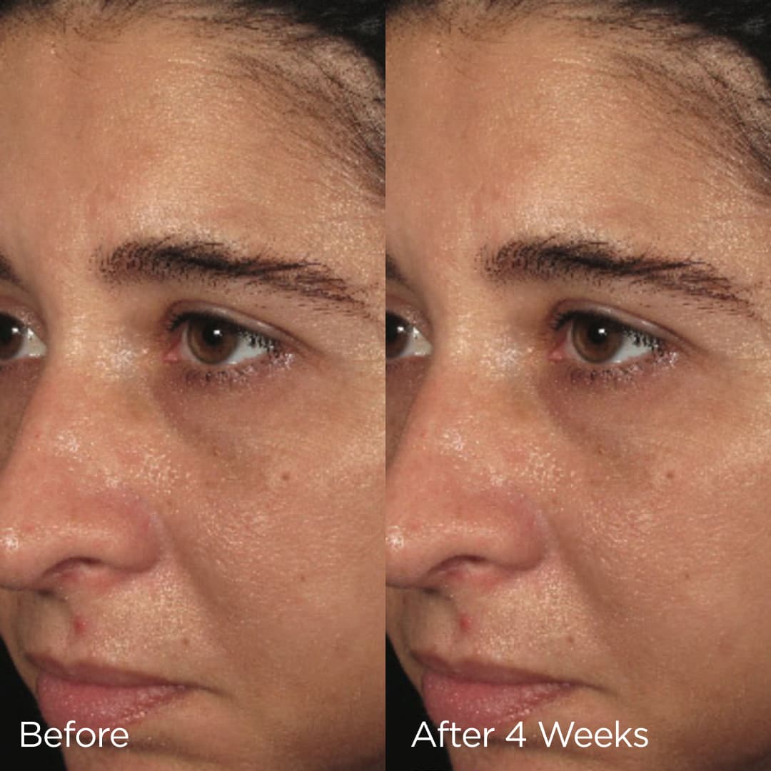 IMAGE Skincare Ormedic Balancing Biopeptide Crème