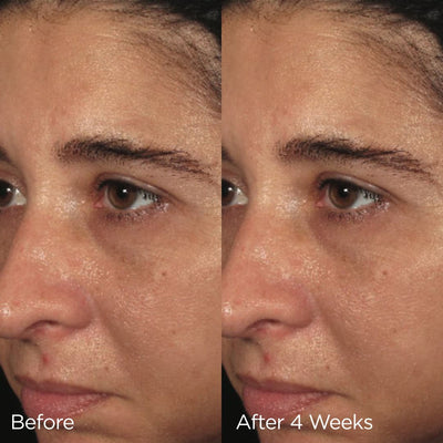 IMAGE Skincare Ormedic Balancing Biopeptide Crème