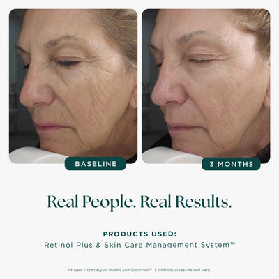 Marini Skin Solutions Retinol Plus