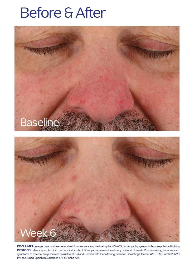 ZO Skin Health Rozatrol®