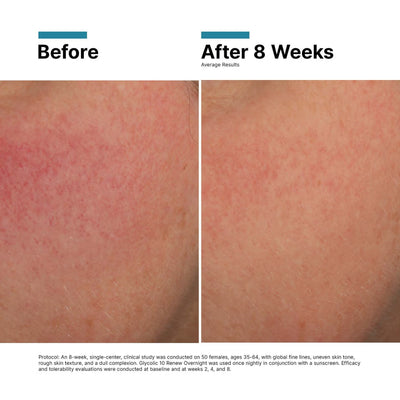 SkinCeuticals Glycolic 10 Renew Overnight