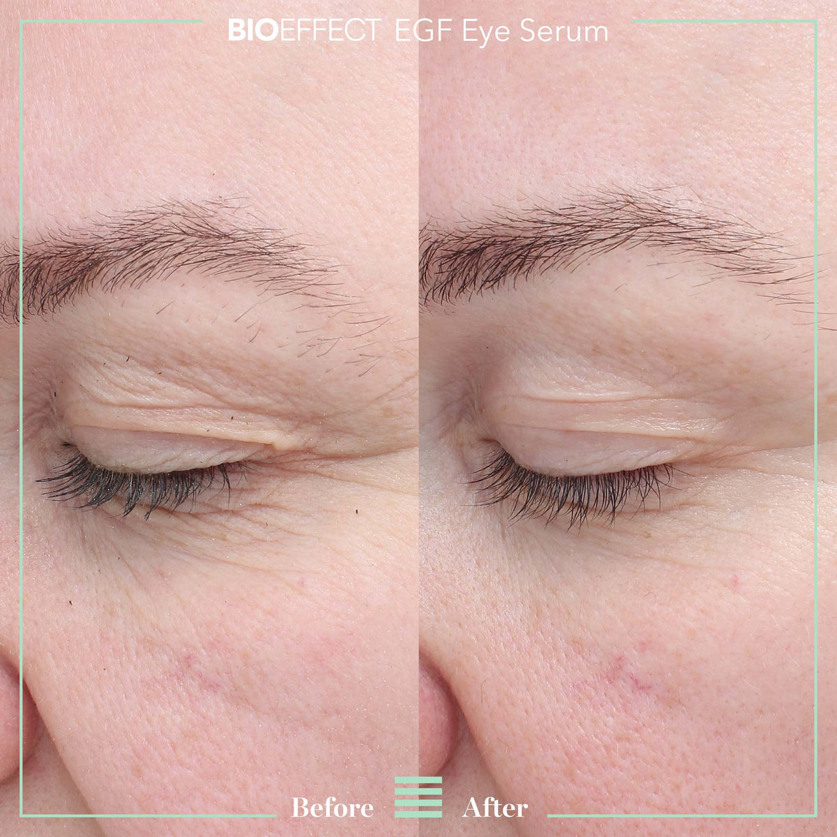 BIOEFFECT EGF Eye Serum