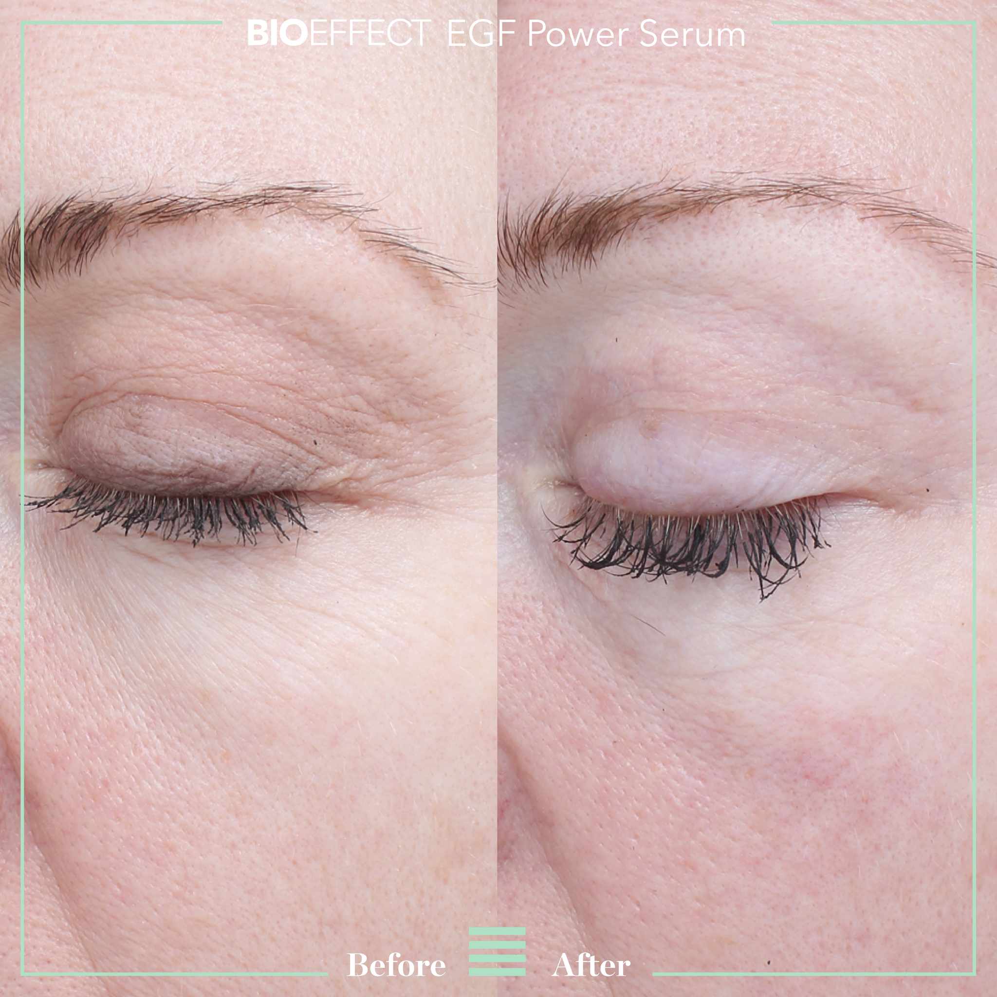 BIOEFFECT EGF Power Serum