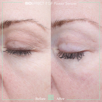 BIOEFFECT EGF Power Serum