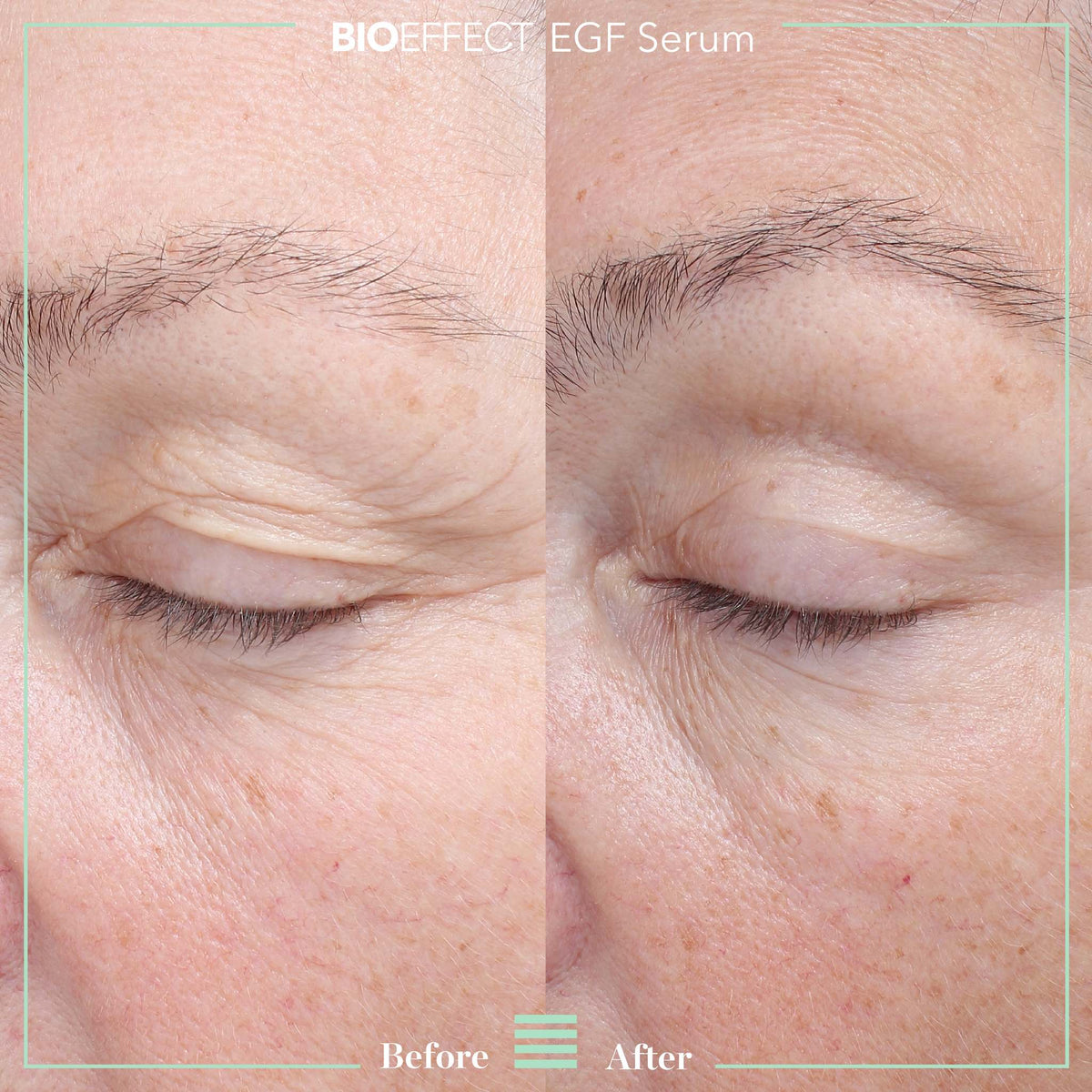 BIOEFFECT EGF Serum