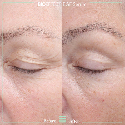 BIOEFFECT EGF Serum