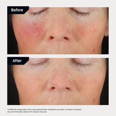 Revision Skincare C+ Correcting Complex 30%