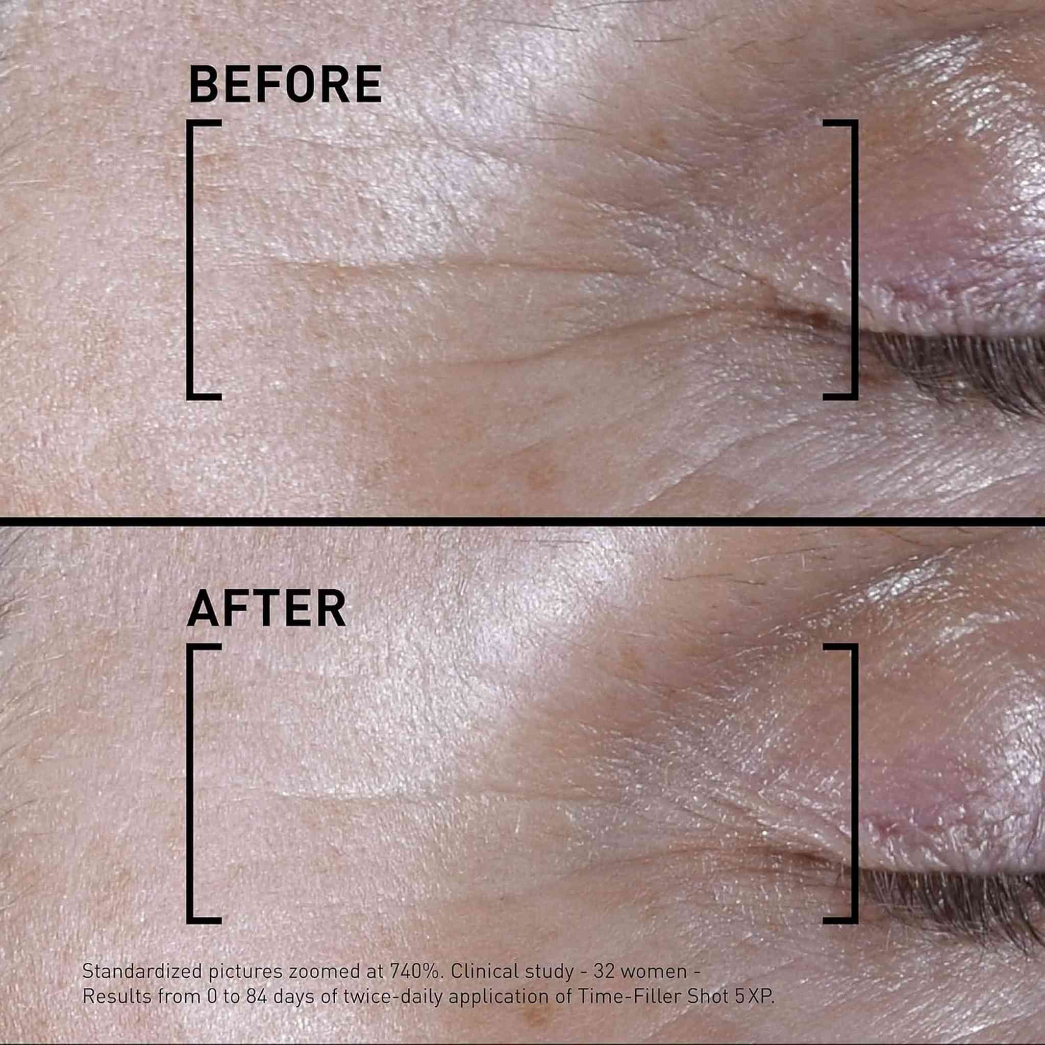 Filorga TIME-FILLER Shot 5XP Serum