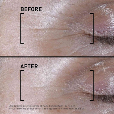 Filorga TIME-FILLER Shot 5XP Serum