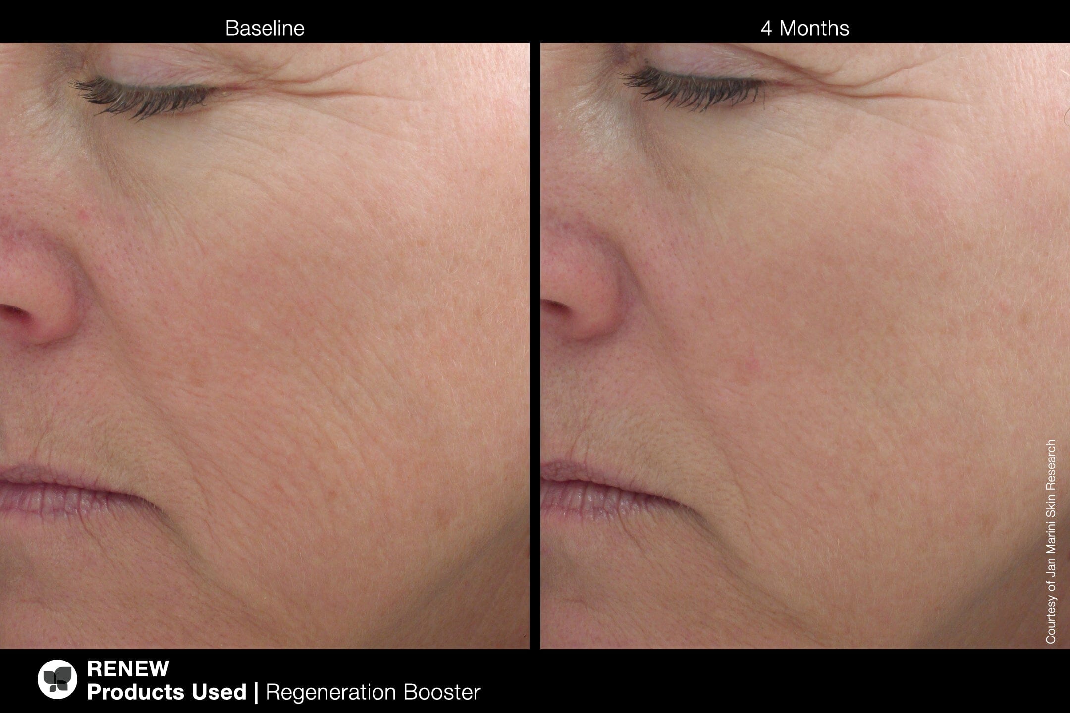 Jan Marini Regeneration Booster Face Lotion