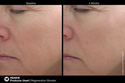 Jan Marini Regeneration Booster Face Lotion