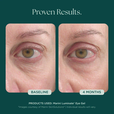 Marini Skin Solutions Marini Luminate Eye Gel