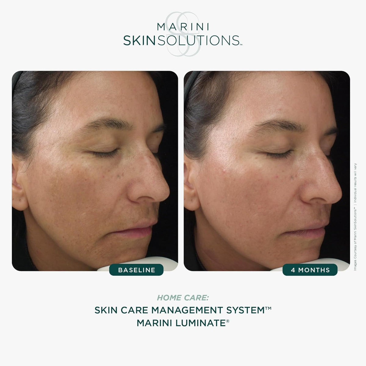 Marini Skin Solutions Marini Luminate Face Lotion