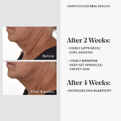 Murad Retinal ReSculpt Overnight Treatment