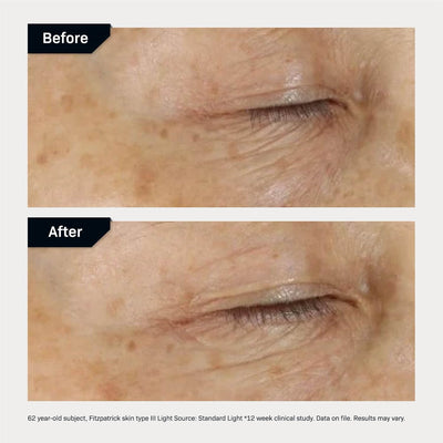 Revision Skincare D.E.J. Eye Cream