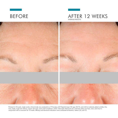 SkinCeuticals A.G.E Interrupter Advanced