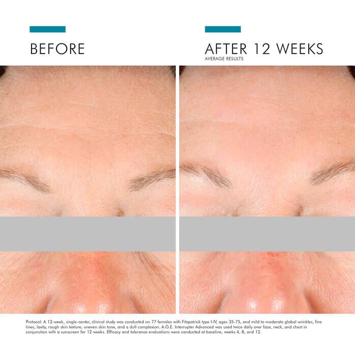 SkinCeuticals A.G.E Interrupter Advanced