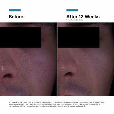SkinCeuticals P-TIOX Anti-Wrinkle Cream