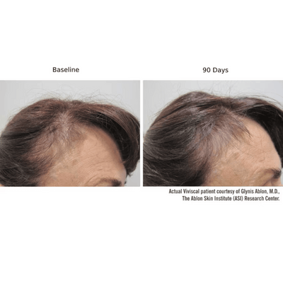 Viviscal PRO Hair Growth Supplement - 9-Month Value Set