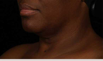 SkinMedica® Neck Correct Neck and Décolleté Cream 1.7 Oz. / 50 ml