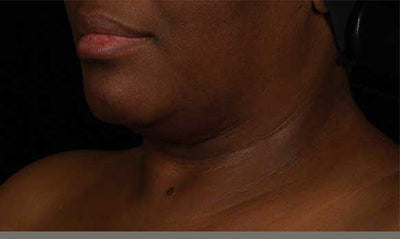 SkinMedica® Neck Correct Neck and Décolleté Cream 1.7 Oz. / 50 ml