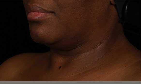 SkinMedica® Neck Correct Neck and Décolleté Cream 1.7 Oz. / 50 ml