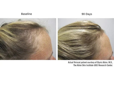Viviscal PRO Hair Growth Supplement - 9-Month Value Set