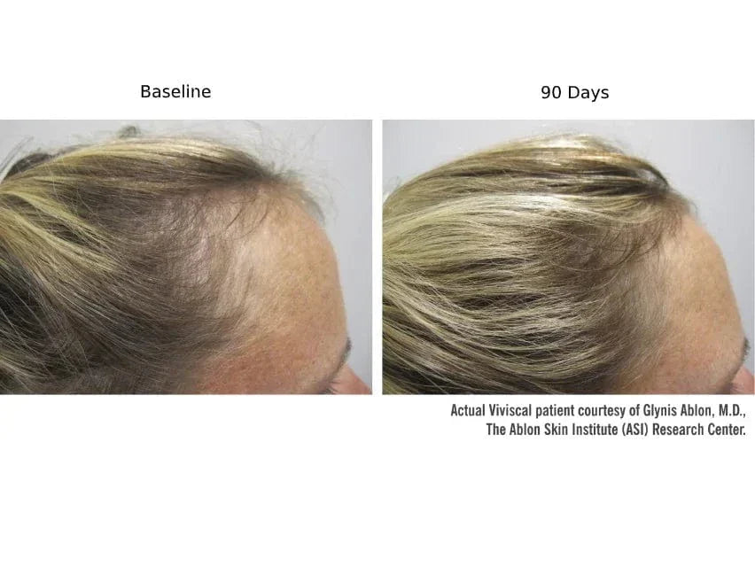 Viviscal PRO Hair Growth Supplement - 9-Month Value Set